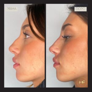 marta pensa prima e dopo