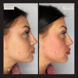 marta pensa prima e dopo