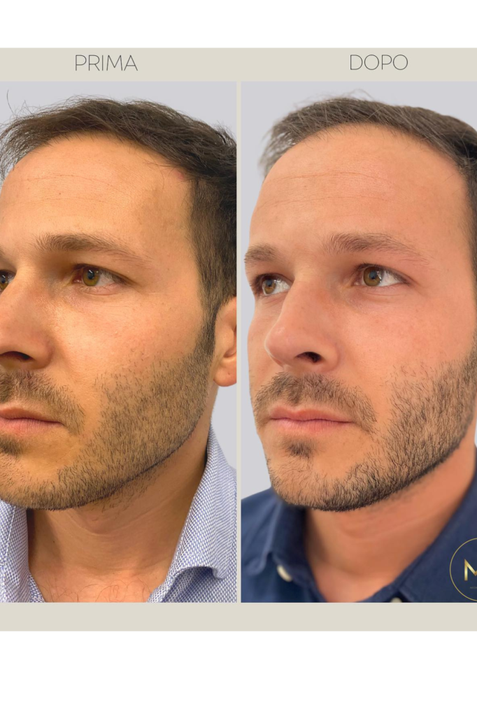 marta pensa prima e dopo