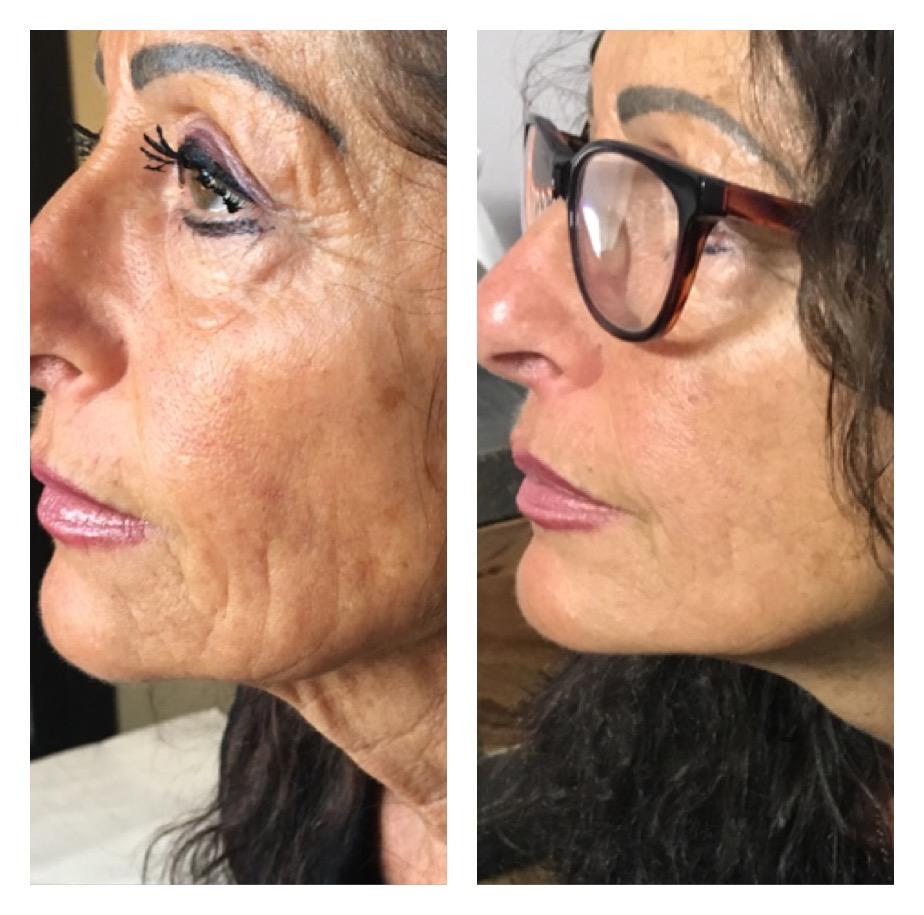 marta pensa prima e dopo 2